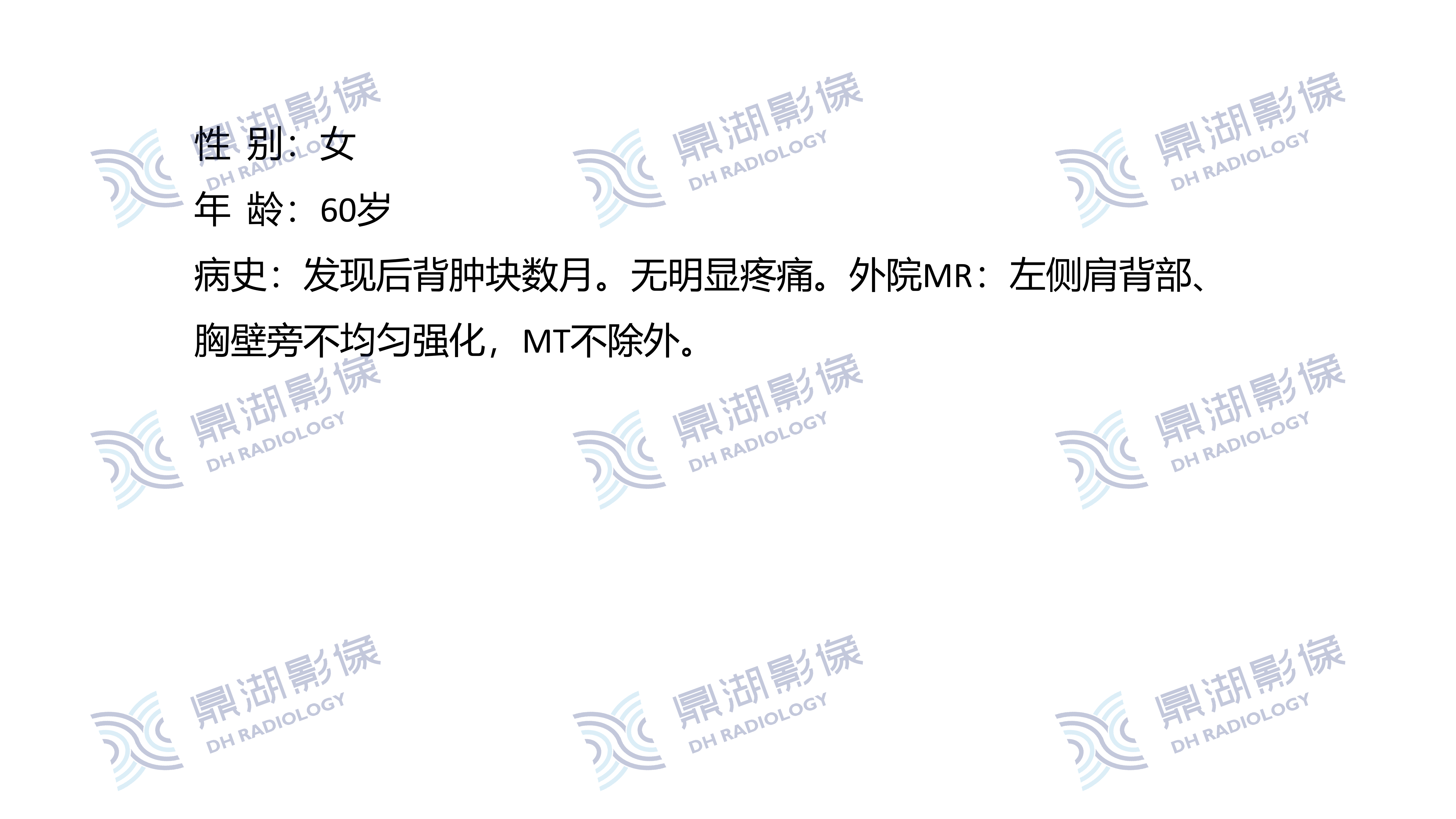 0717老年人的左肩肿块PETCT如何诊断_02.png